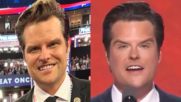 "OMFG! Botox Failure!"— Twitter Reacts To Dramatic Matt Gaetz ...